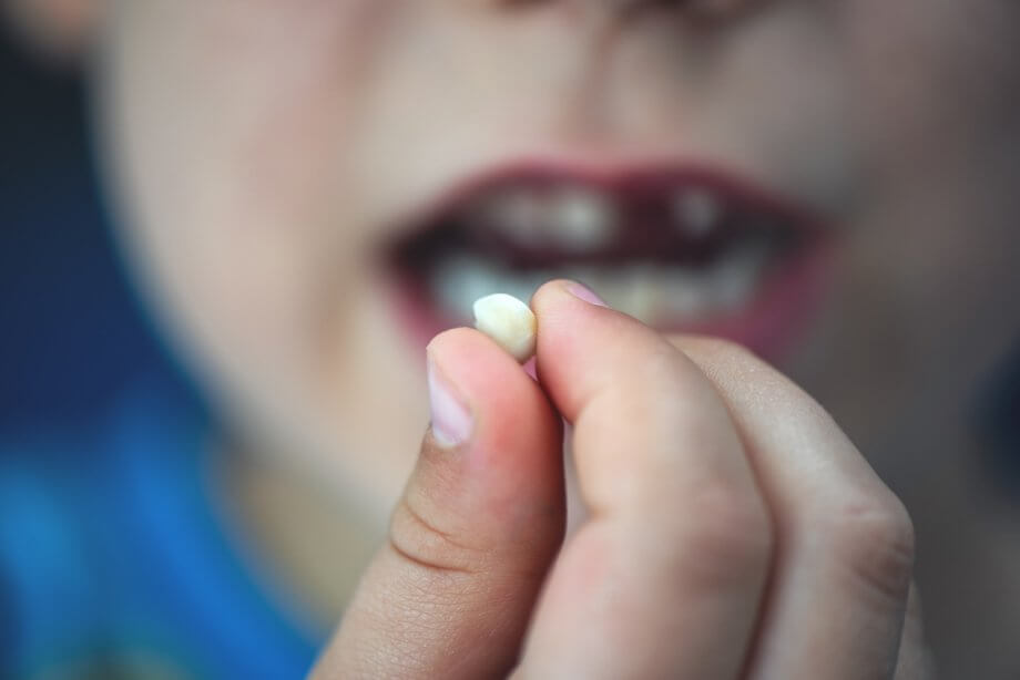 Boy losing a tooth